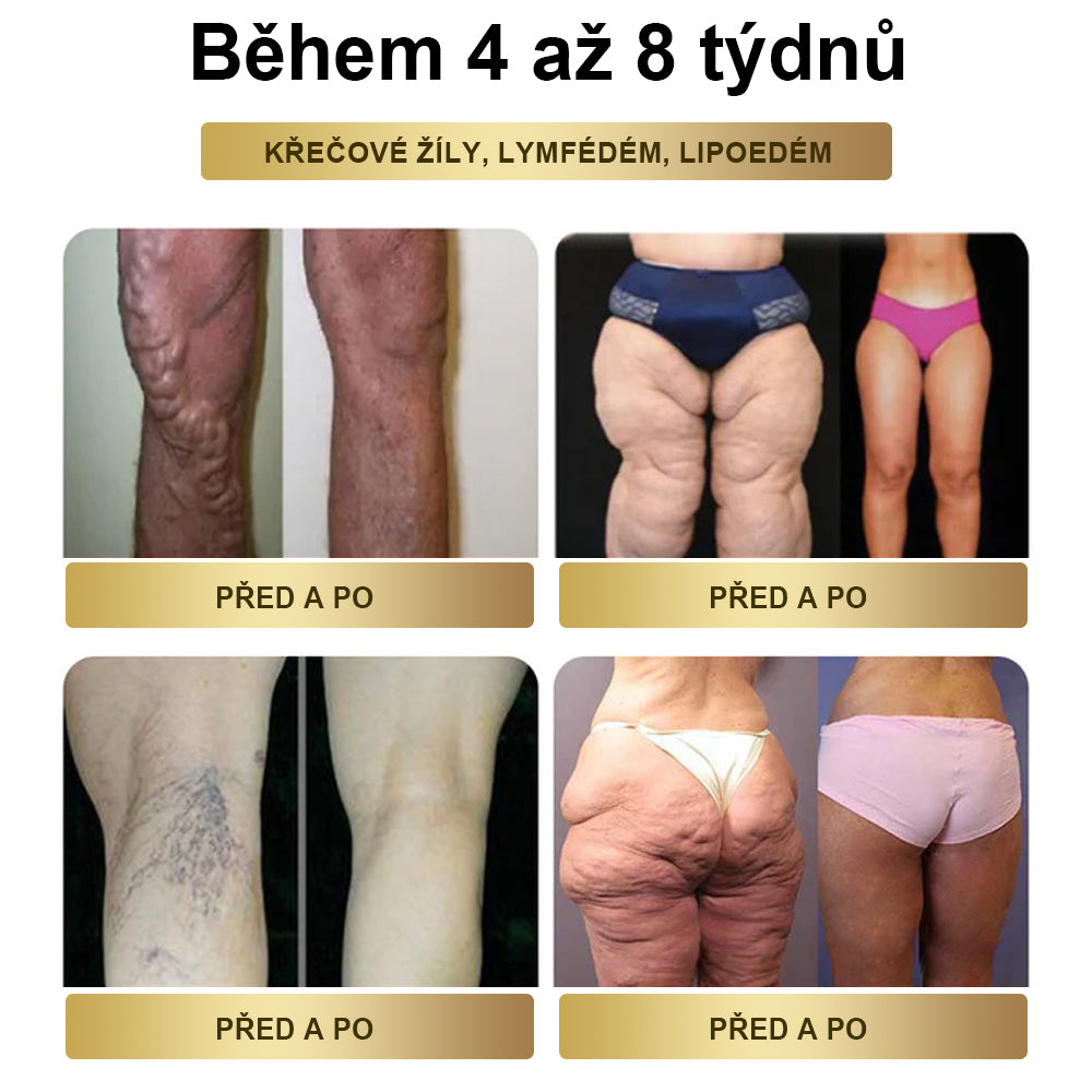 BuildLeaf®🎁 Zbývá už jen 5 krabic! Nabízíme vám extra slevu 50 %! Buďte fit a zdraví. Když to teď nestihnete, budete mít další šanci až příští rok.