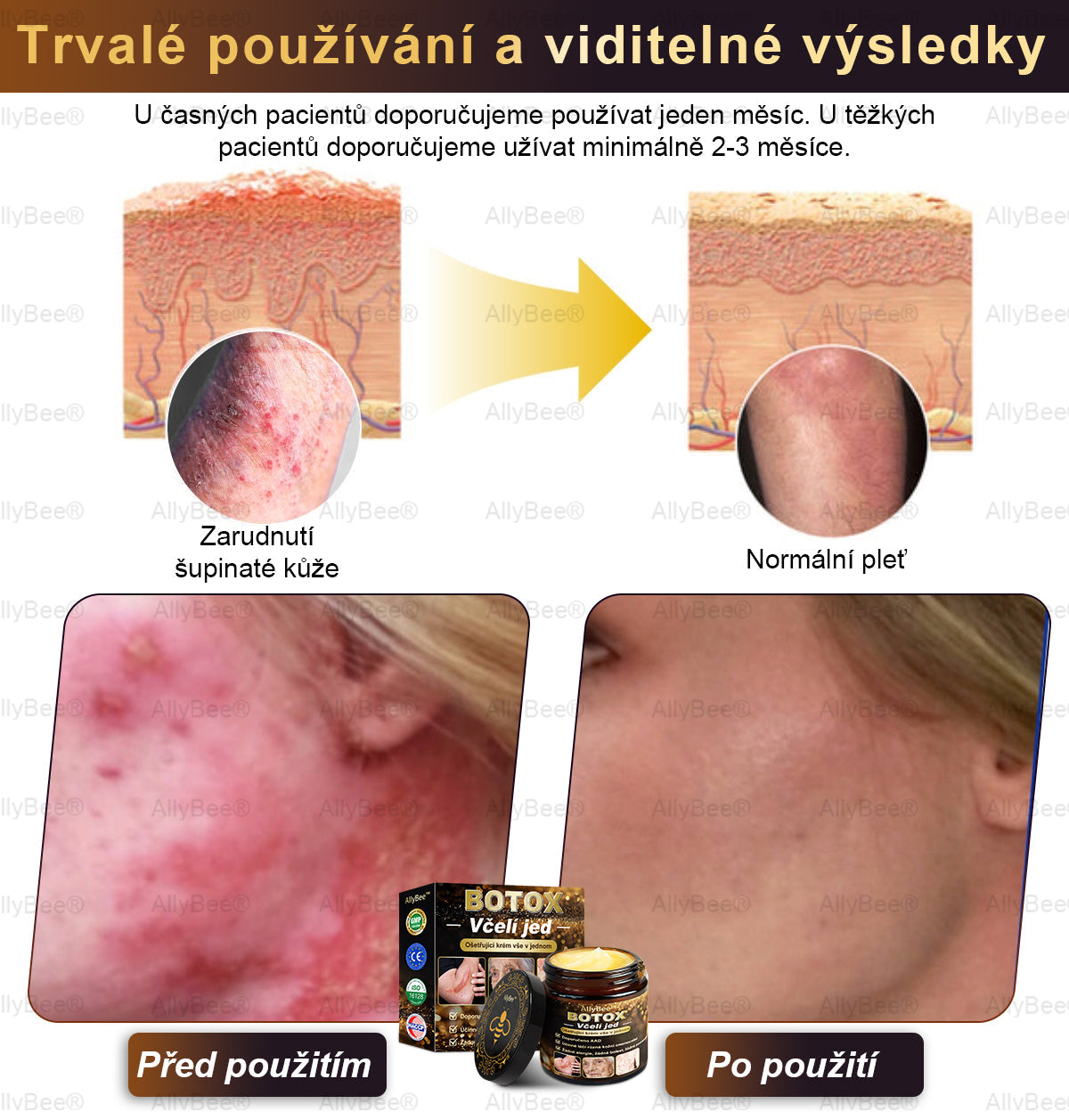 🎁 Zbývá už jen 5 krabic! Nabízíme vám extra slevu 50 %! Buďte fit a zdraví. Když to teď nestihnete, budete mít další šanci až příští rok.