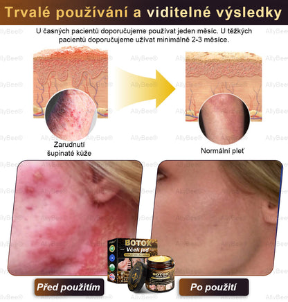 🎁 Zbývá už jen 5 krabic! Nabízíme vám extra slevu 50 %! Buďte fit a zdraví. Když to teď nestihnete, budete mít další šanci až příští rok.