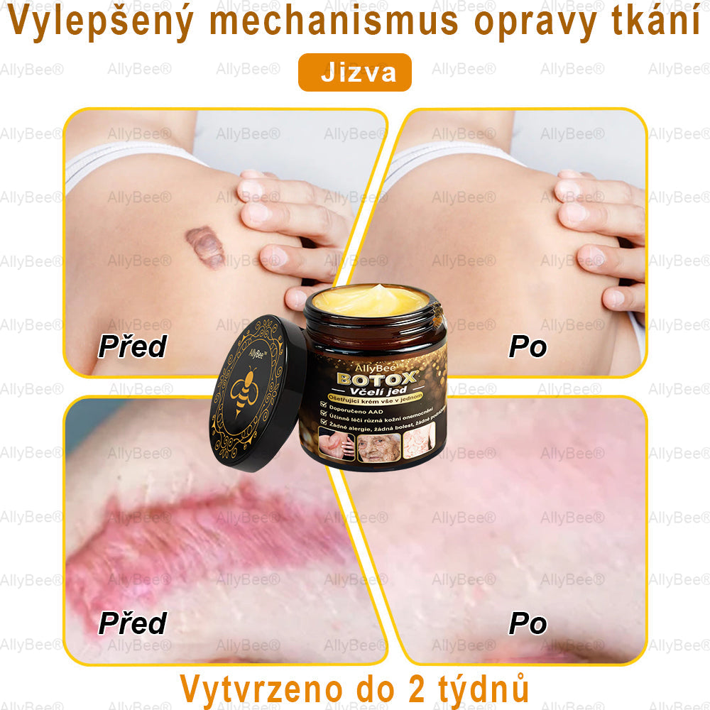 🎁 Zbývá už jen 5 krabic! Nabízíme vám extra slevu 50 %! Buďte fit a zdraví. Když to teď nestihnete, budete mít další šanci až příští rok.