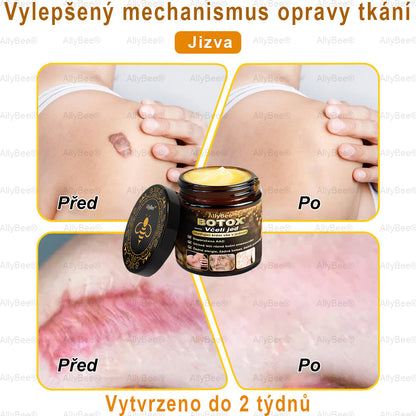🎁 Zbývá už jen 5 krabic! Nabízíme vám extra slevu 50 %! Buďte fit a zdraví. Když to teď nestihnete, budete mít další šanci až příští rok.