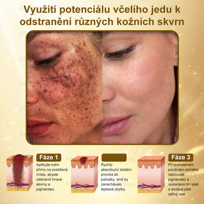 🎁 Zbývá už jen 5 krabic! Nabízíme vám extra slevu 50 %! Buďte fit a zdraví. Když to teď nestihnete, budete mít další šanci až příští rok.