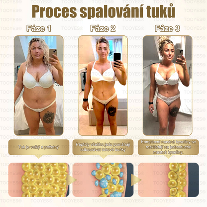 Doporučeno Mayo Clinic | Oficiální obchod | TOOYES® Metatrolid a Moringa GLP-1 aktivace, Jablečný ocet, Kurkuma Bylinná ústní tekutina: Obezita, kardiovaskulární onemocnění, cukrovka, spánková apnoe, kloubní problémy, a další